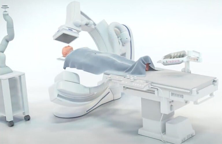 Système de thrombectomie mécanique autonome Sasha d'Artedrone.