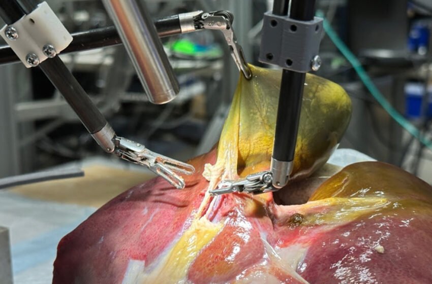 Johns Hopkins enseigne au robot à effectuer une élimination de la vésicule biliaire sur un patient réaliste